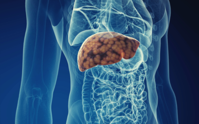 How to Reverse Fatty Liver Naturally!