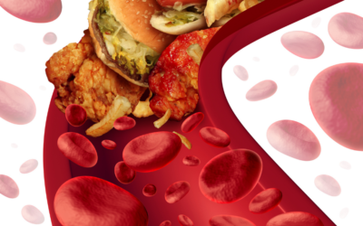 What Does It Mean to Have High Cholesterol?